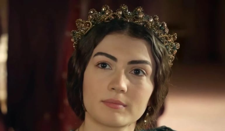 BURCU ÖZBERK’TEN ESTETİK İDDİALARINA YANIT: “SADECE DİŞ ESTETİĞİ YAPTIRDIM”